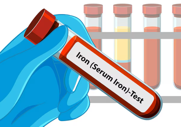 Iron Tests (Ferritin, Serum Iron & TIBC): Understanding Results